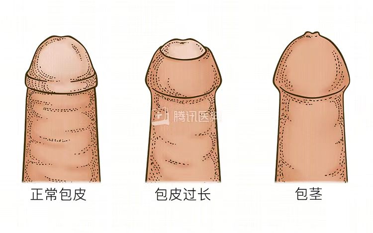 ba83c0b3e8962c2e005403ccf4a37087